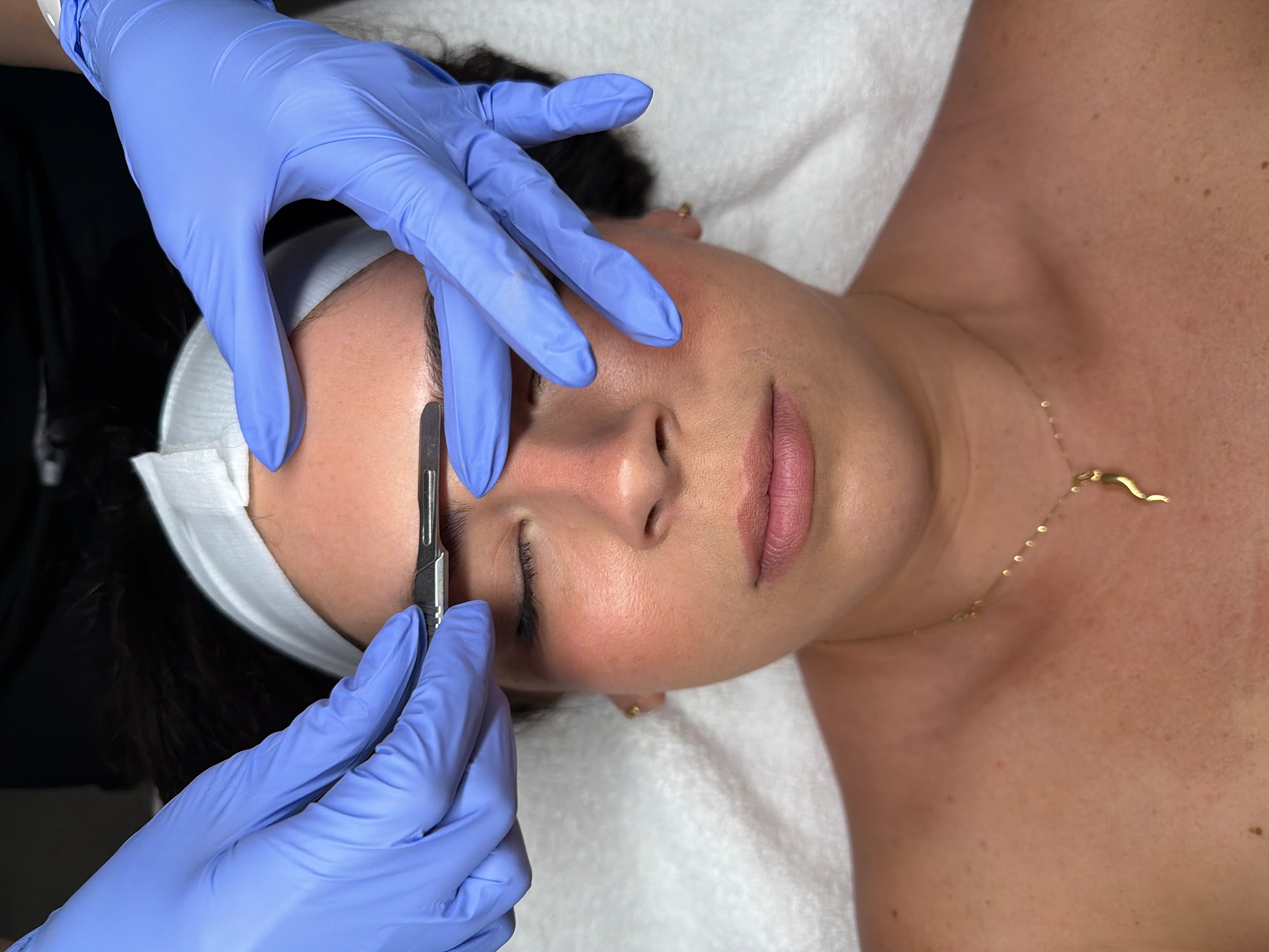 Woman receiving facial treatment with dermaplaning tool.